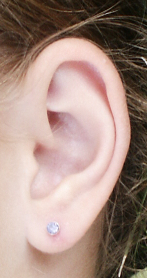Bolest ucha