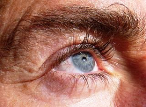 Rady na červené žilky v oku