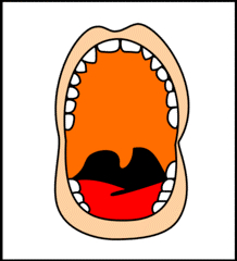 Nejčastější nemoci úst